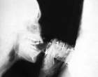 amazing xray.jpg
