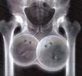 Balls.jpg