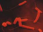 Coloured em1 ecoli 2.JPG